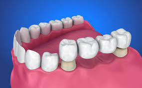 NY Dental | Invisalign reg , Cosmetic Dentistry and Dental Implants